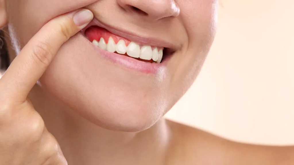 This giant tropical fruit could help reverse gum disease damage This giant tropical fruit could help reverse gum disease damage
