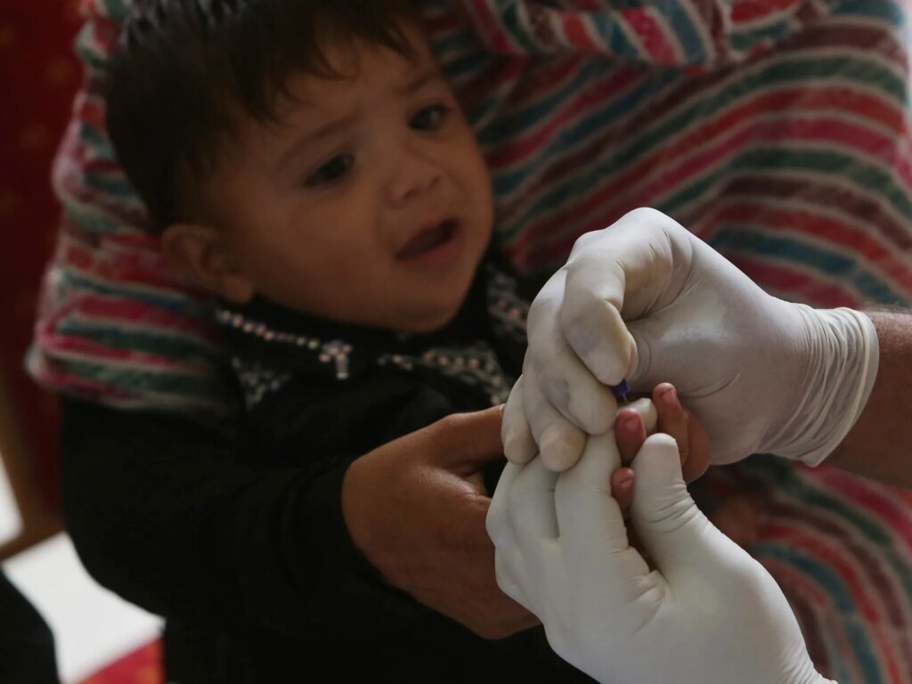Why is Pakistan’s Sindh province facing a major child HIV outbreak? | HIV/AIDS News Why is Pakistan’s Sindh province facing a major child HIV outbreak? | HIV/AIDS News