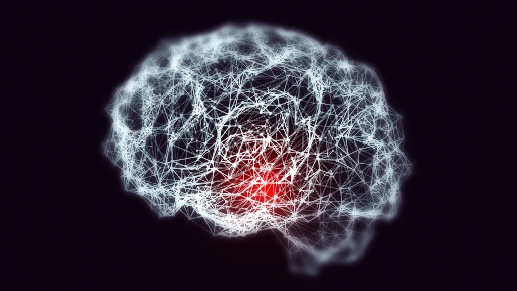 Iron overload: The hidden culprit behind early Alzheimer’s in Down syndrome Iron overload: The hidden culprit behind early Alzheimer’s in Down syndrome