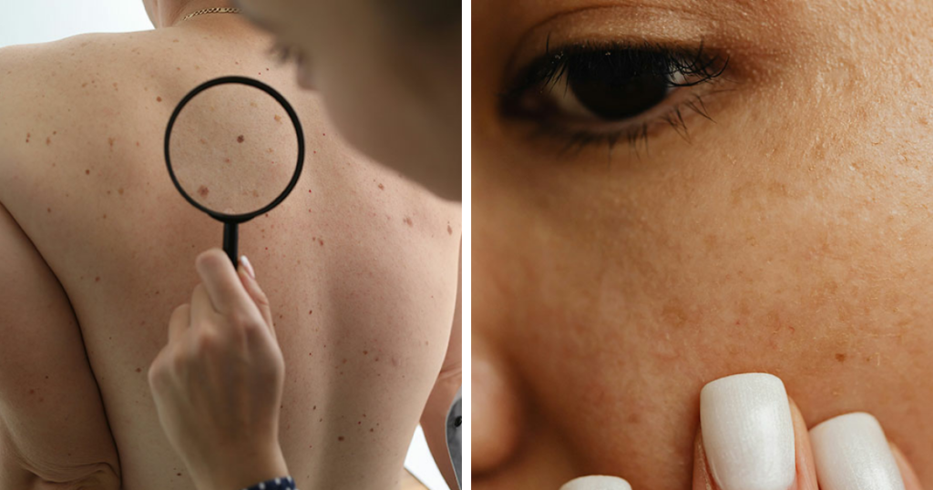 Dermatologist Reveals The Major Red Flag On Your Skin That Could Signal Heart Problems Dermatologist Reveals The Major Red Flag On Your Skin That Could Signal Heart Problems