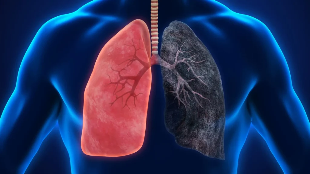 Heavy marijuana smoking may increase cancer risk, researchers warn Heavy marijuana smoking may increase cancer risk, researchers warn