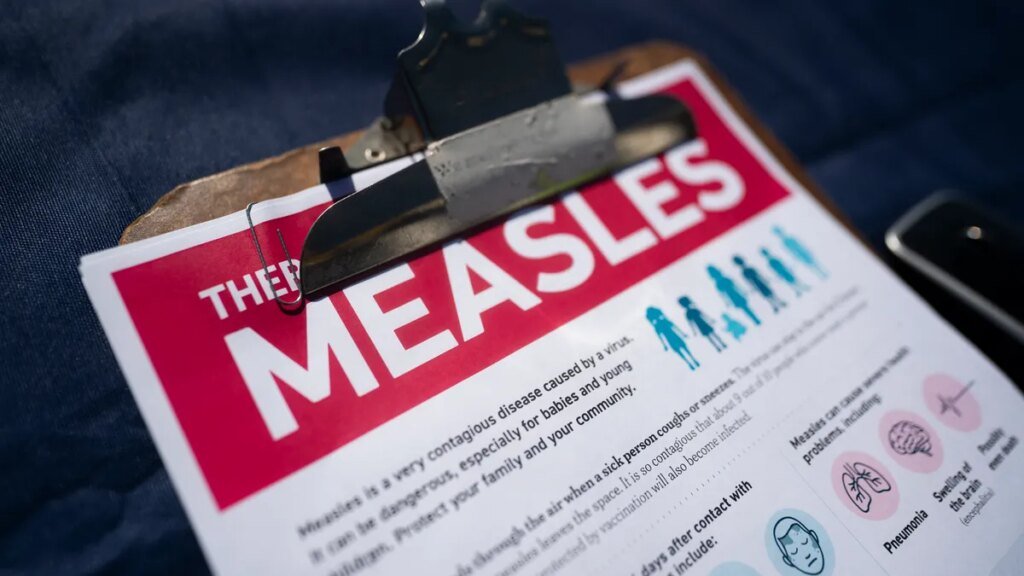 Measles cases top 2,295, highest since 1991