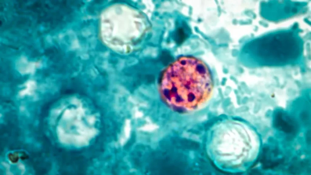 More than 400 sick as CDC searches for the source of a mystery outbreak More than 400 sick as CDC searches for the source of a mystery outbreak