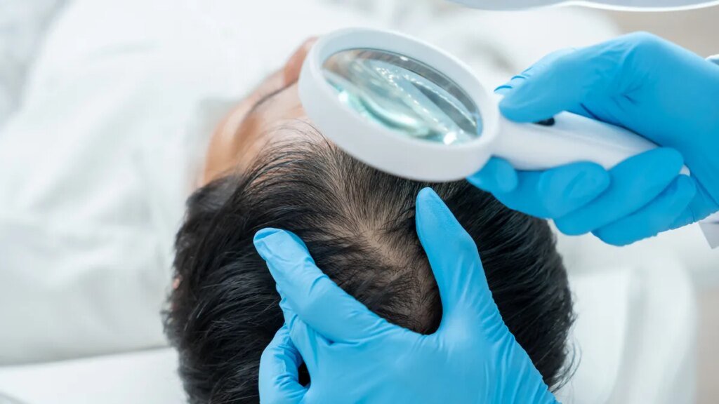 Ozempic, Wegovy users may face higher risk of hair loss, studies find Ozempic, Wegovy users may face higher risk of hair loss, studies find