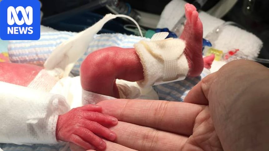 Perth medical researchers working on artificial placentas for premature babies Perth medical researchers working on artificial placentas for premature babies