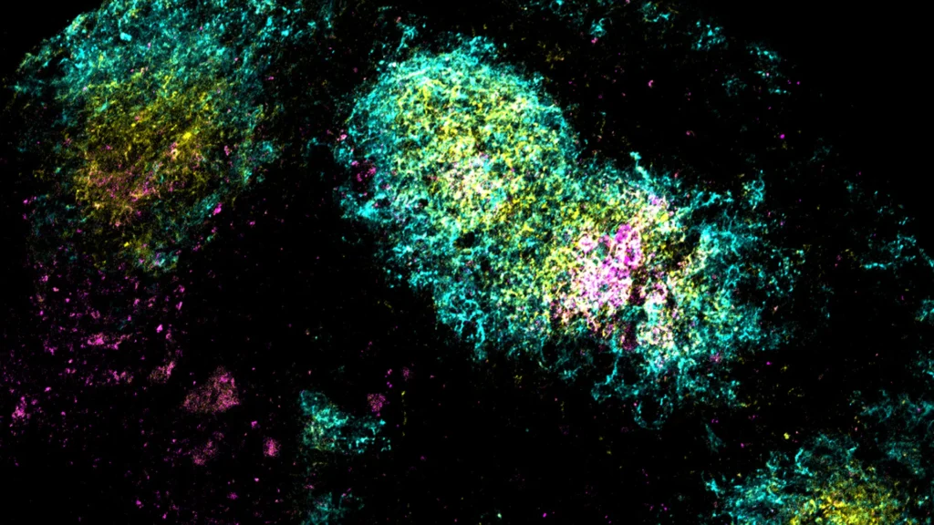 One shot to stop HIV: MIT’s bold vaccine breakthrough One shot to stop HIV: MIT’s bold vaccine breakthrough