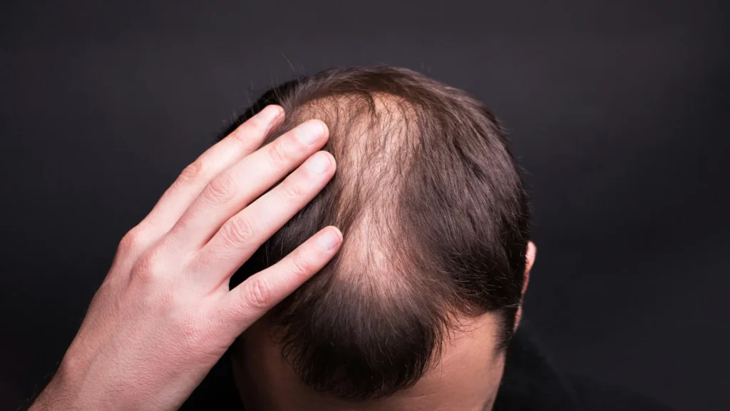 Textbooks were wrong: Scientists reveal how human hair really grows Textbooks were wrong: Scientists reveal how human hair really grows