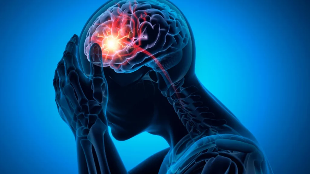 The real cause of a common stroke may have been missed for decades The real cause of a common stroke may have been missed for decades