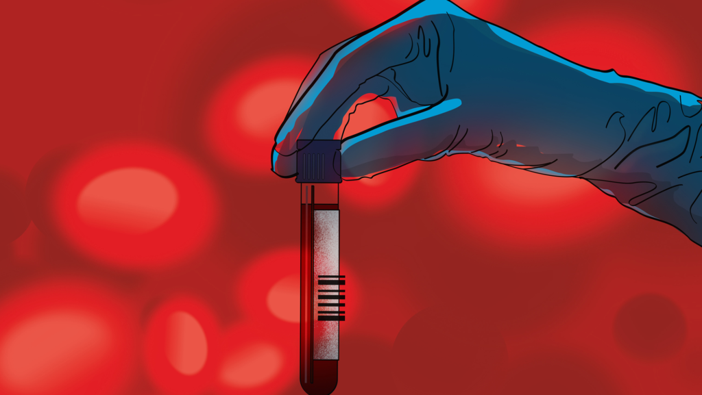 Earlier diagnosis but limited treatment options: What to know about blood tests for Alzheimer’s disease Earlier diagnosis but limited treatment options: What to know about blood tests for Alzheimer’s disease