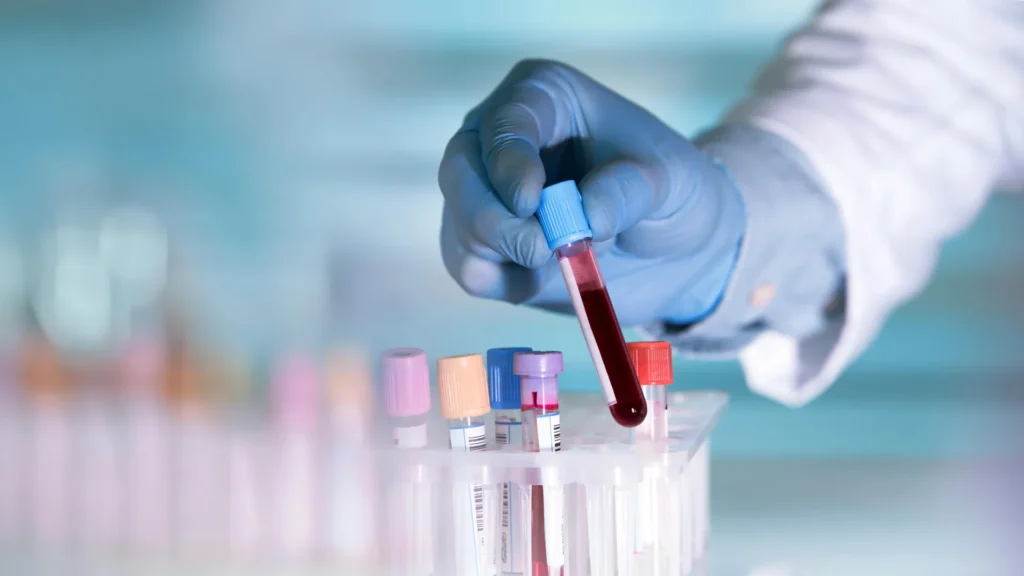 Simple test could better predict your risk of heart disease Simple test could better predict your risk of heart disease