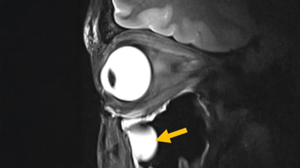 New MRI breakthrough reveals the brain and eye like never before New MRI breakthrough reveals the brain and eye like never before
