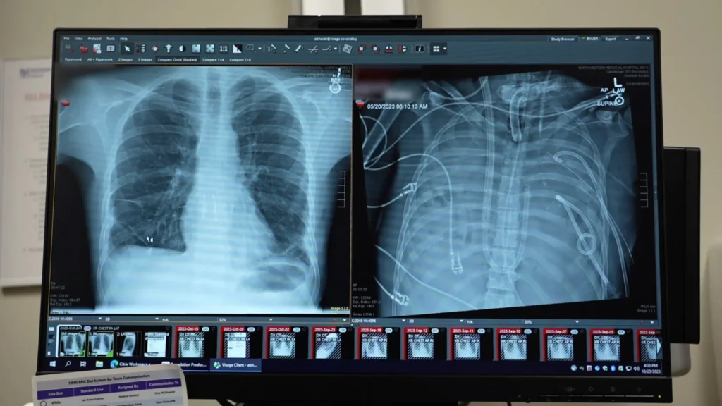 He survived 48 hours without lungs and lived He survived 48 hours without lungs and lived