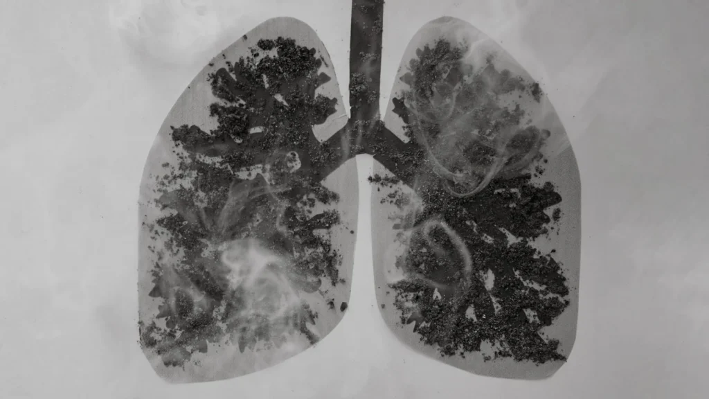 Unusual carbon build-up found in lungs of COPD patients Unusual carbon build-up found in lungs of COPD patients