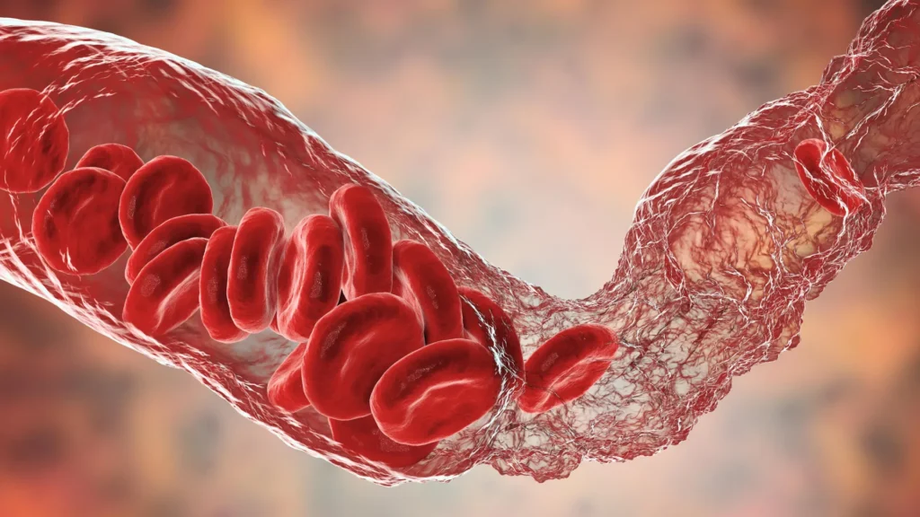 Even mild Covid may leave blood vessels five years older Even mild Covid may leave blood vessels five years older