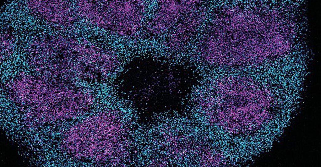 A Study of Brain Proteins Offers New Targets to Treat Autism A Study of Brain Proteins Offers New Targets to Treat Autism
