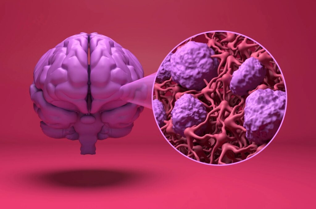 Blood-brain barrier-crossing blood pressure drugs linked to lower dementia risk Blood-brain barrier-crossing blood pressure drugs linked to lower dementia risk