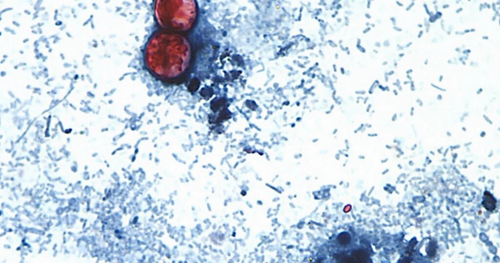 Cyclospora outbreak linked to recalled iceberg lettuce tied to 3 more states, FDA says