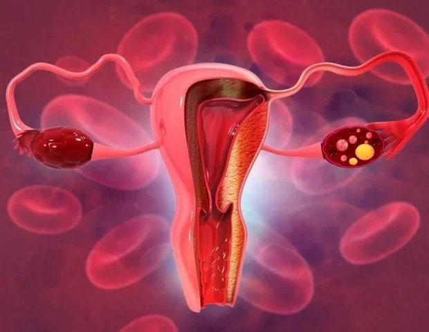 High antioxidant diet linked to lower risk of cervical cancer in women High antioxidant diet linked to lower risk of cervical cancer in women