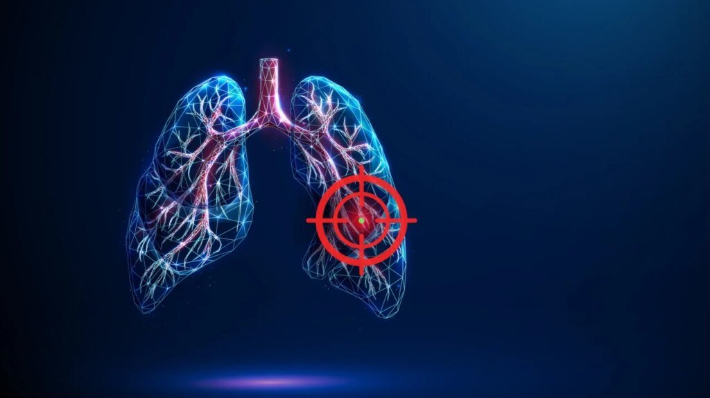 Biokin bispecific ADC iza-bren hits goal in lung cancer trial, boosting case for BMS’ global test Biokin bispecific ADC iza-bren hits goal in lung cancer trial, boosting case for BMS’ global test