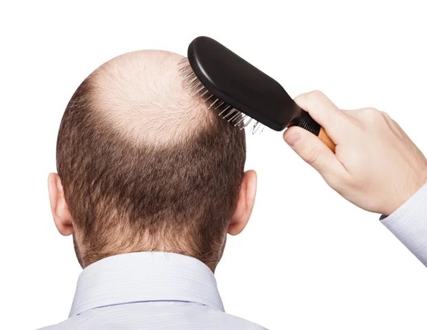 New 3D mapping technology reveals how hair follicles form over time New 3D mapping technology reveals how hair follicles form over time