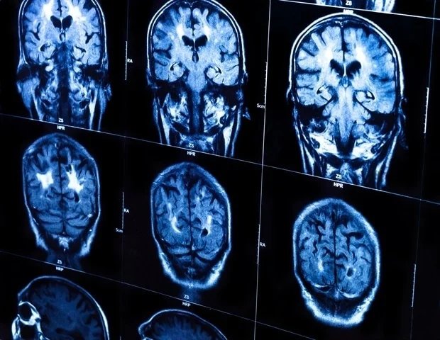 Res-SwinFusion improves anatomical landmark localization with hybrid AI approach Res-SwinFusion improves anatomical landmark localization with hybrid AI approach