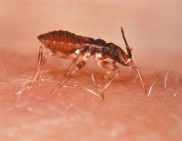 Scientists uncover tRNA changes driving Chagas parasite transformation Scientists uncover tRNA changes driving Chagas parasite transformation