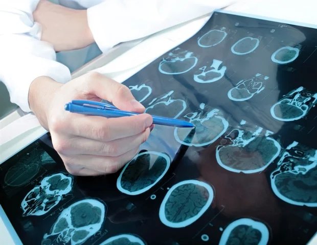 Shared protein pathology redefines treatment for multiple neurodegenerative diseases Shared protein pathology redefines treatment for multiple neurodegenerative diseases