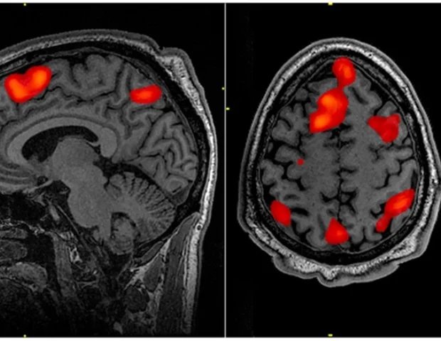 Two distinct types of brain tissue work together to support cognition in older adults Two distinct types of brain tissue work together to support cognition in older adults
