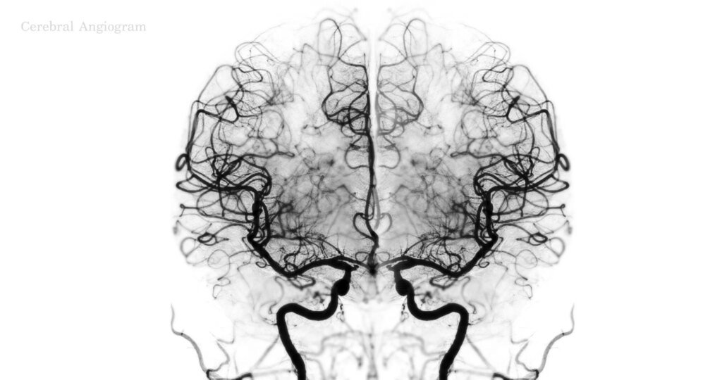 Wake-activated brain circuits reveal what drives the urge to sleep