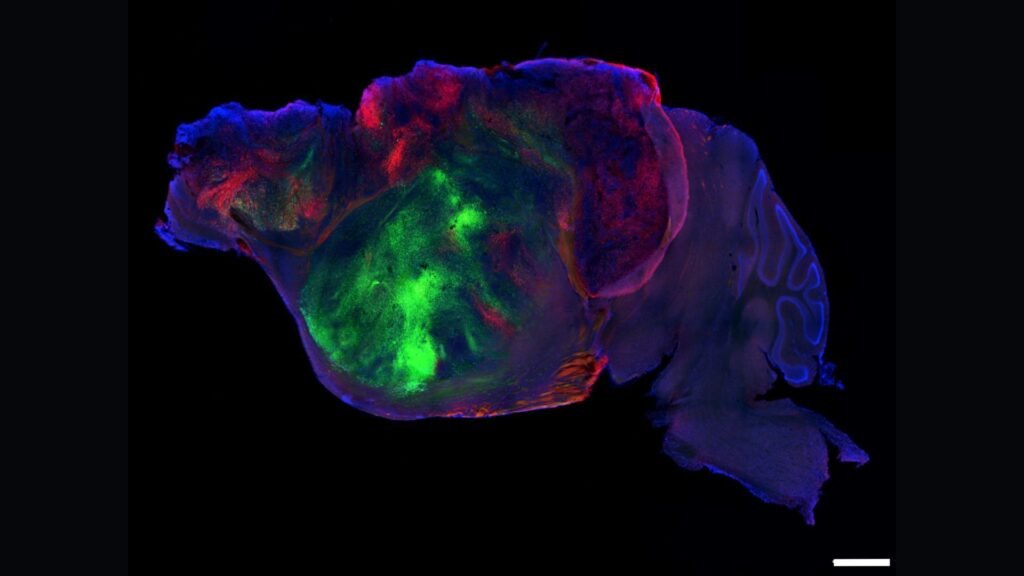 Scientists shrank mice’s brains and replaced the missing tissue with human ‘organoids’ Scientists shrank mice’s brains and replaced the missing tissue with human ‘organoids’
