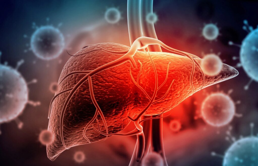 Alcohol-related liver cancer deaths were falling. Then the trend reversed during the COVID-19 pandemic