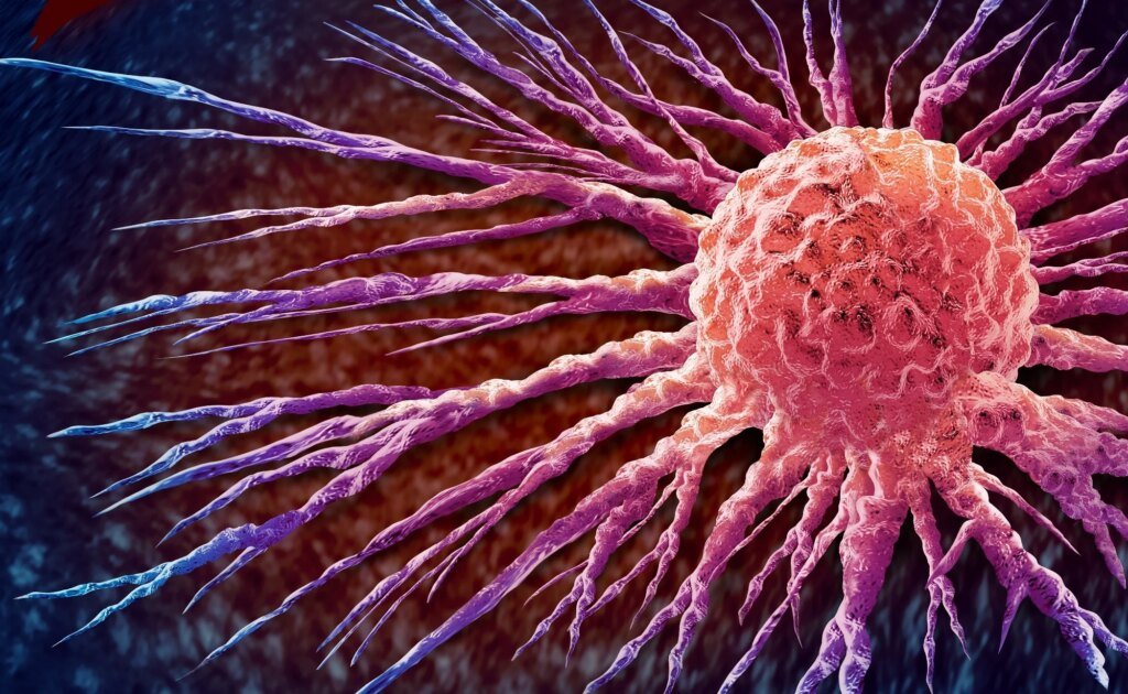 Breast cancer AI test finds no single chatbot excels across every measure Breast cancer AI test finds no single chatbot excels across every measure