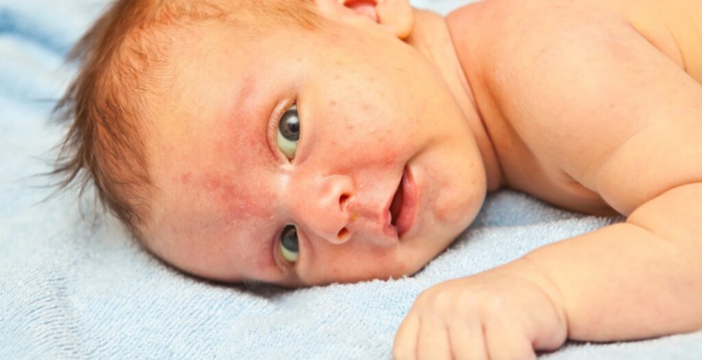 Common chemical exposures in pregnancy may be linked to early attention and memory Common chemical exposures in pregnancy may be linked to early attention and memory