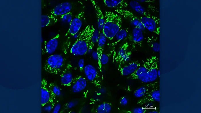 Engineered nanoparticles sensitize gliomas to radiotherapy Engineered nanoparticles sensitize gliomas to radiotherapy