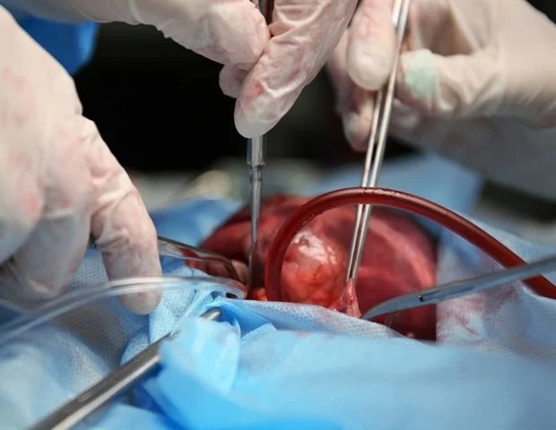 Muscle matters: Simple scan could predict heart surgery risks Muscle matters: Simple scan could predict heart surgery risks