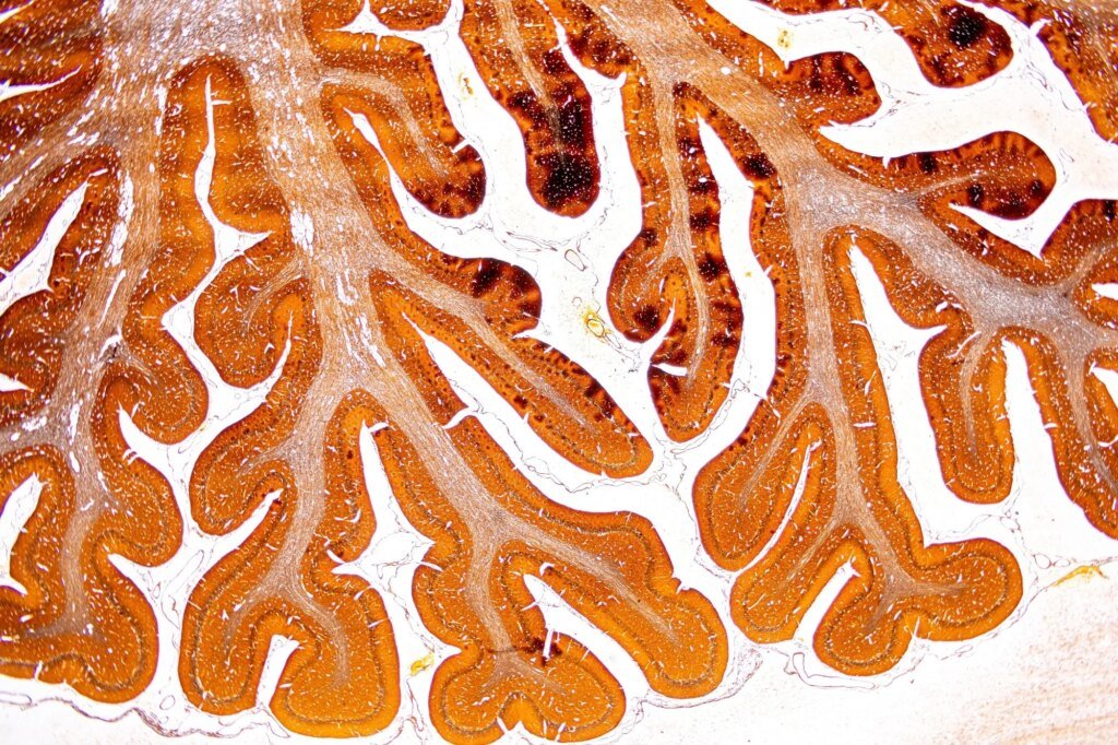 Some mice showed signs of stress resilience before the stress even began Some mice showed signs of stress resilience before the stress even began