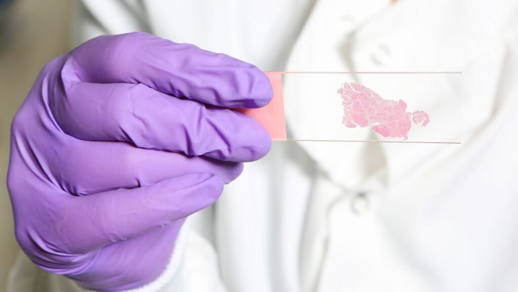 AI trained to ‘think’ like human pathologists may be better at spotting cancer AI trained to ‘think’ like human pathologists may be better at spotting cancer