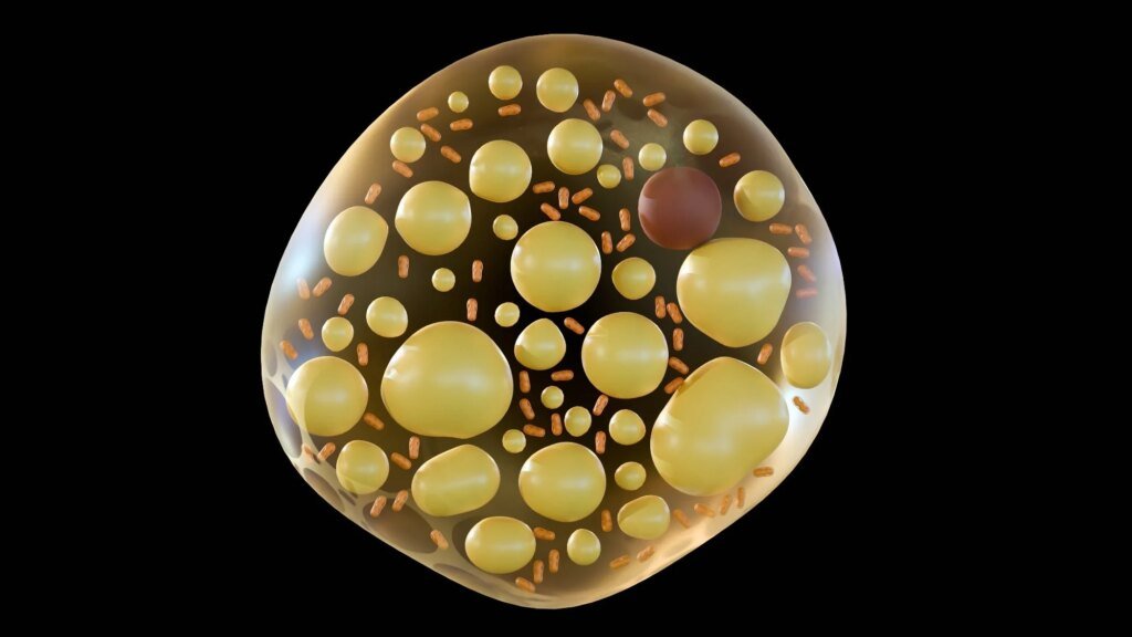 AI study of 101,000 patients links brown fat to heart and mental health