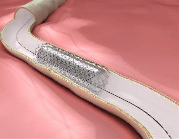 ASTM International approves new surgical device standard ASTM International approves new surgical device standard