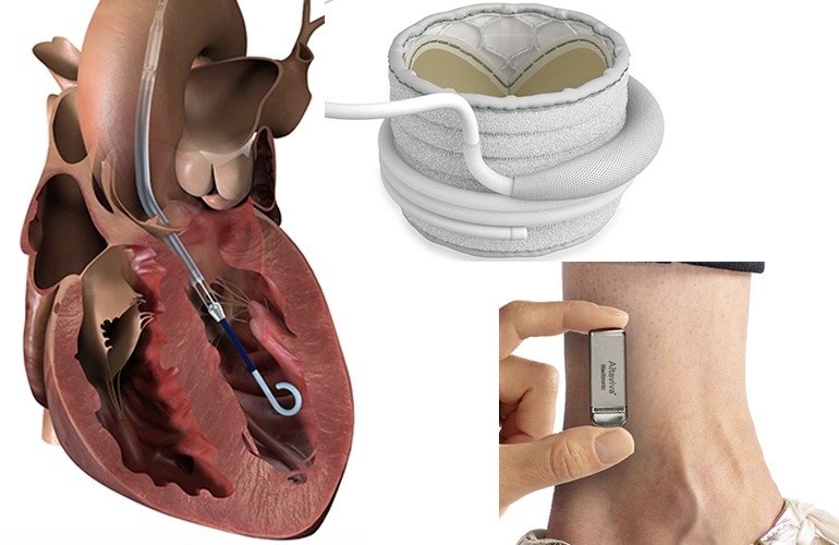 The most innovative medical devices of 2026 The most innovative medical devices of 2026
