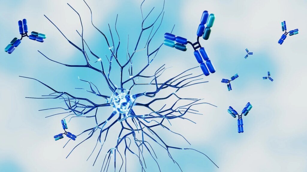 Nearly one in three women with autoimmune diseases waited at least four years for a diagnosis, survey finds Nearly one in three women with autoimmune diseases waited at least four years for a diagnosis, survey finds