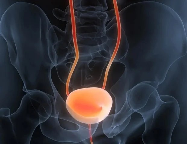 Simple urine test can accurately diagnose and track bladder cancer Simple urine test can accurately diagnose and track bladder cancer
