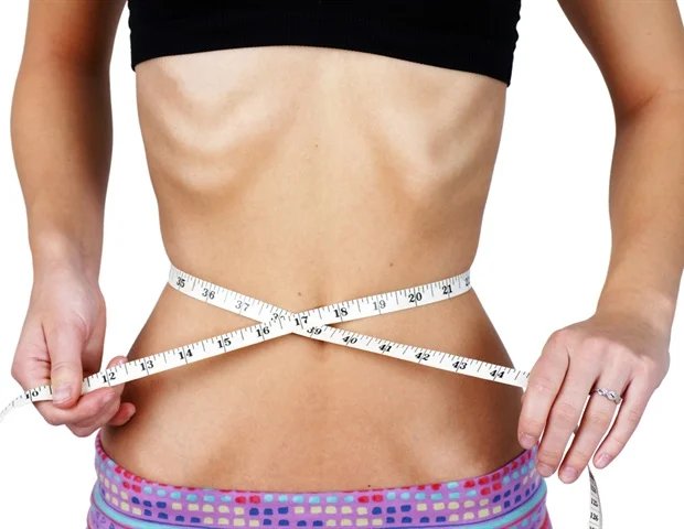 Study links non-brain gene variant to anorexia risk Study links non-brain gene variant to anorexia risk