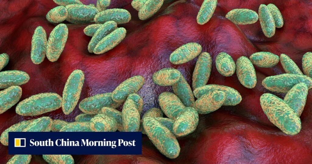 The plague isn’t history. Where it still exists, how it spreads and a cure