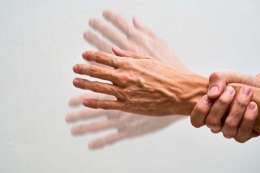 Year-long trial finds NAD-boosting supplement fails to improve early Parkinson’s symptoms